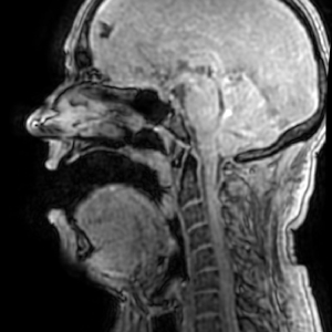 MRI scan image including vocal tract