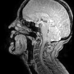 MRI scan image including vocal tract