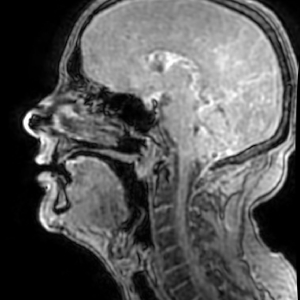 MRI scan image including vocal tract